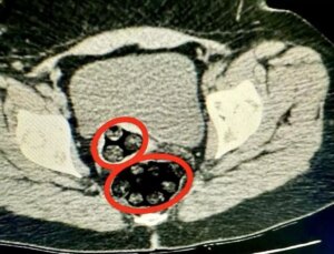İranlı Uyuşturucu Kuryesi Tutuklandı