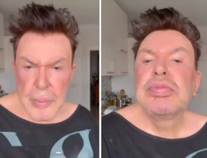 Kuşum Aydın estetik sonrası son halini paylaştı! Değişimi gündem oldu