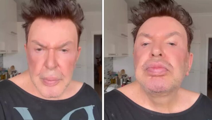 Kuşum Aydın estetik sonrası son halini paylaştı! Değişimi gündem oldu